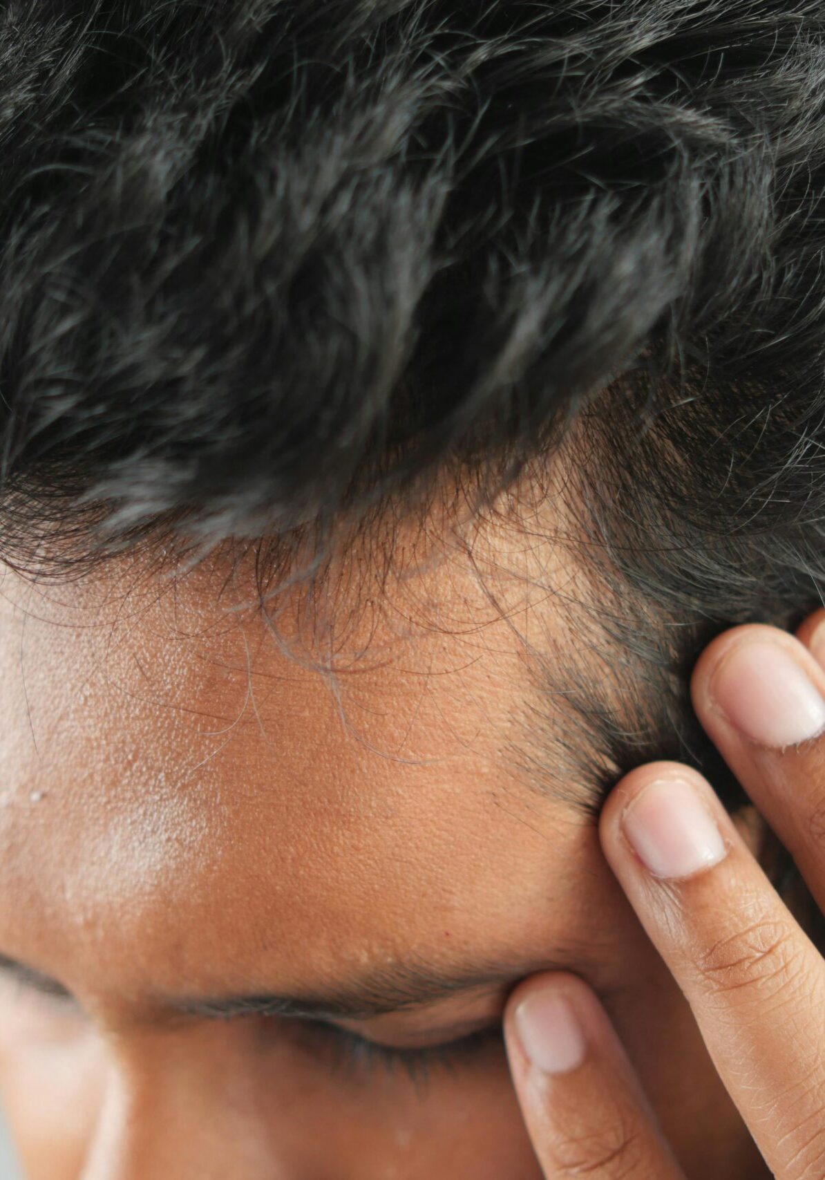 PRP Injections for Hair Regenerative Medicine of Carmel